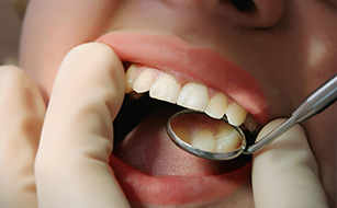 Overall Health - Benefits of Regular Dental Checkups