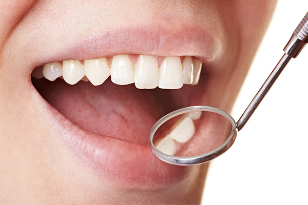 Common Myths about Dental Checkups